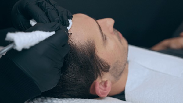 A Patient Relaxing During A Scalp Micropigmentation Midtown Manhattan Session, Showing The Comfort Of Our Non-Surgical Solutions.