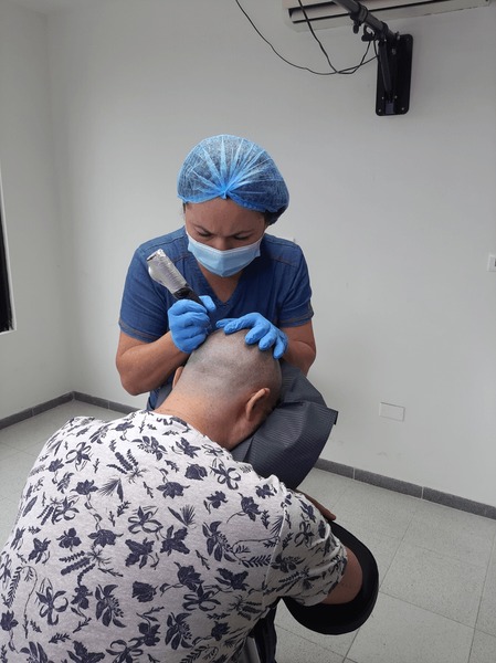 Specialist In A Clinical Setting Performing Scalp Micropigmentation Nyc On A Patient'S Crown For Maximum Density.