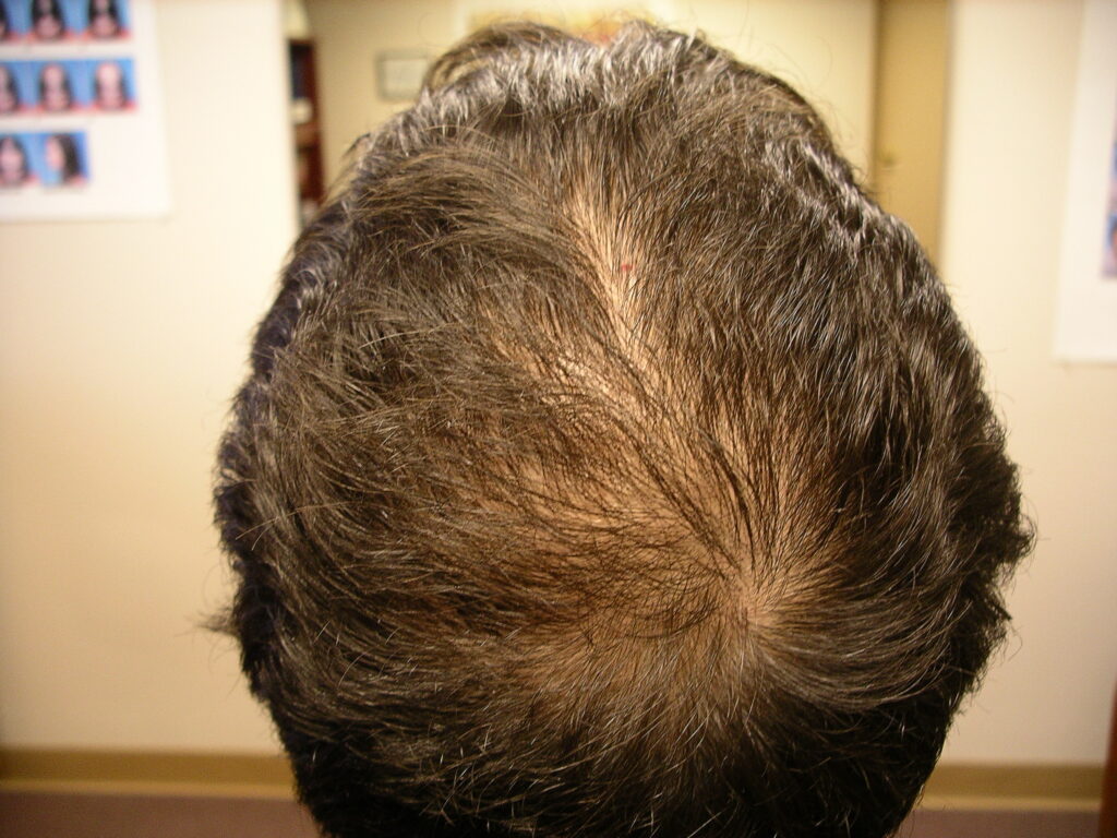 After