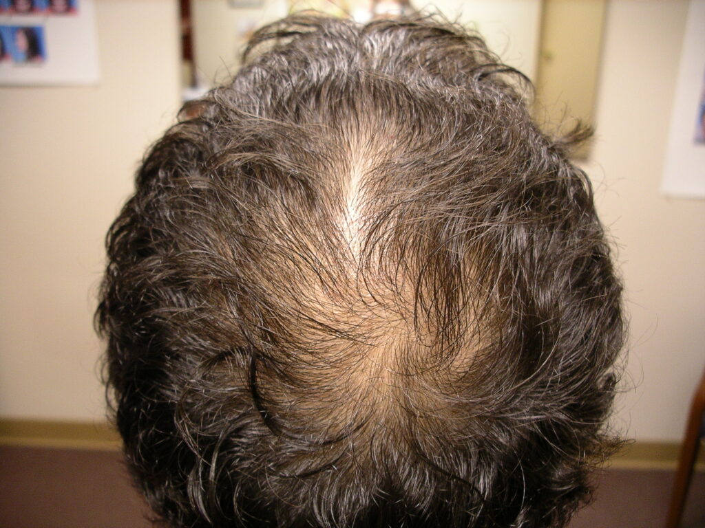 Before