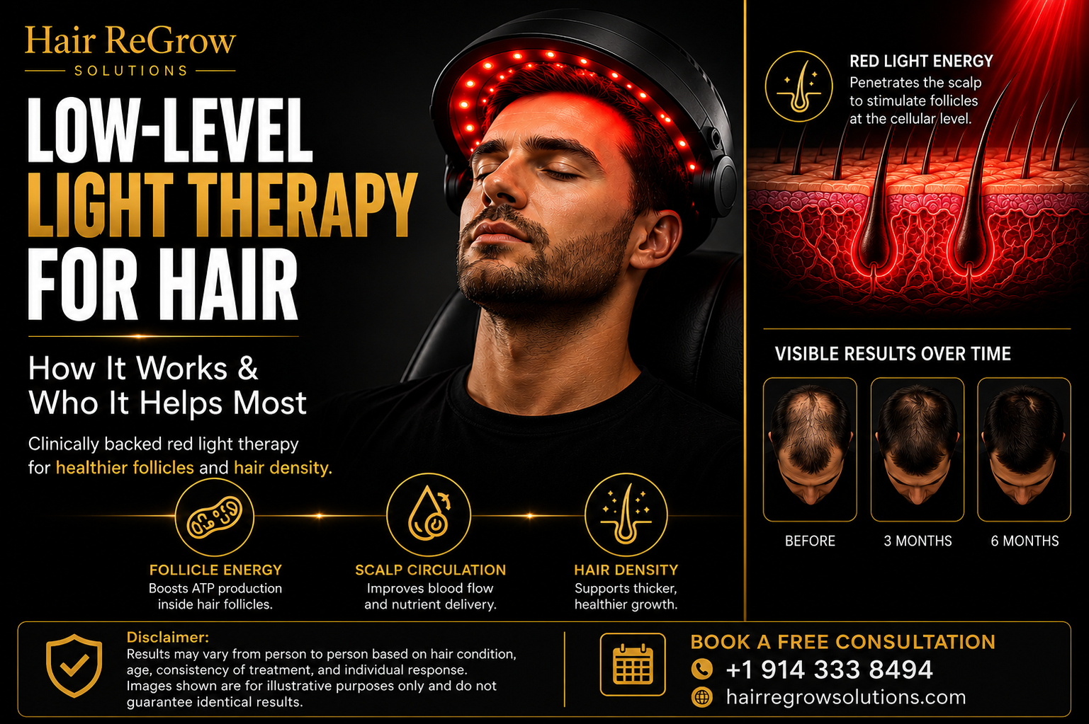 Low-level light therapy for hair restoration using red light scalp treatment for hair density and follicle stimulation