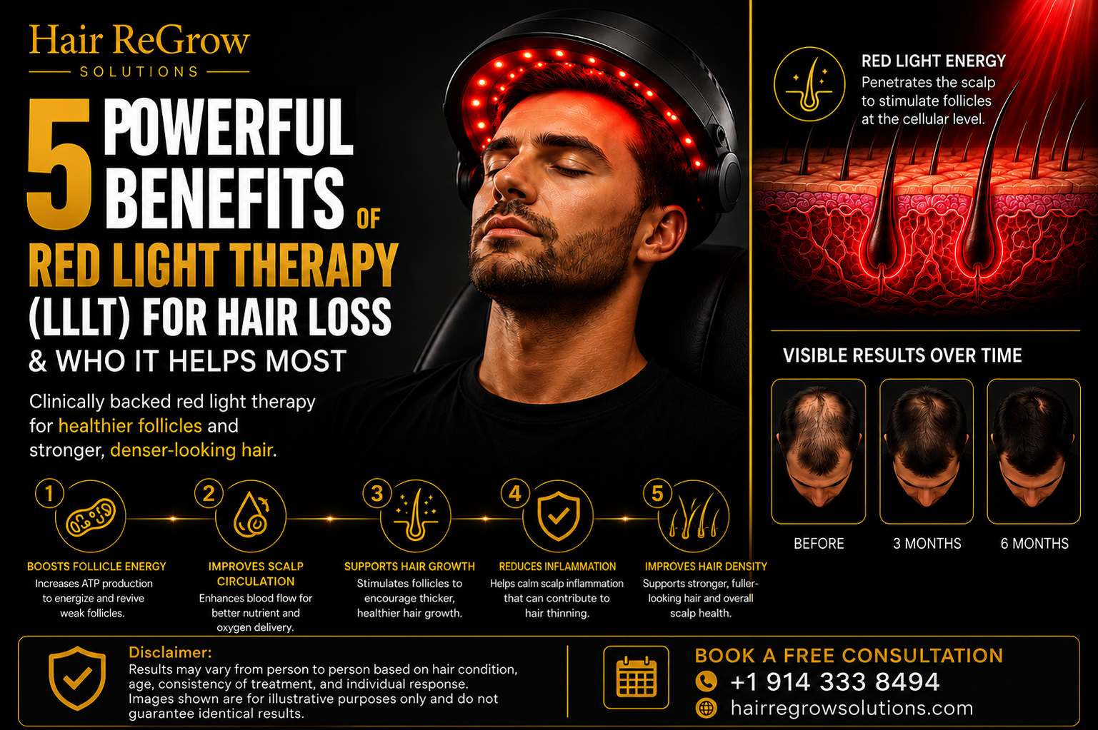 Red light therapy (LLLT) treatment for hair loss using a low-level light therapy helmet to support scalp circulation, follicle energy, and healthier hair density.